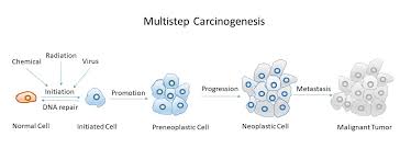 Learn how cancer grows and about mutation of cancer cells with cancer research uk. 7 2 Carcinogenesis Medicine Libretexts