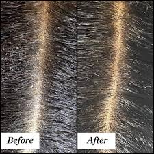 Using bleach and not washing your hair properly are also the major reasons for hair tangle. How To Exfoliate Your Scalp Sunday Riley