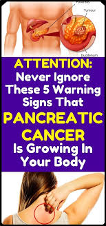 These are the stages of cancer of the pancreas: Health And Fitness Anti Cancer Health Benefits Cancer
