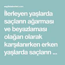 Sac Beyazlamasi Nasil Onlenir Sac Beyazlamasini Onleyen Dogal Oneriler Kisisel Bakim Sac Dogal Saglik