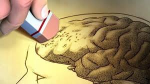 Resultat d'imatges de alzheimer