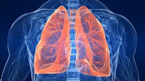 Nov 16, 2013 · te doare spatele? Coronavirus Ce Se IntamplÄ Cu PlÄmanii Celor Care Fac Pneumonie Si Mor Din Cauza Covid 19 Durere In PlÄmani