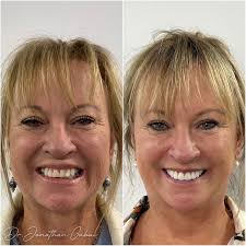 Dr. Jonathan Gabai (@drjonathangabai) · Instagram 照片和视频