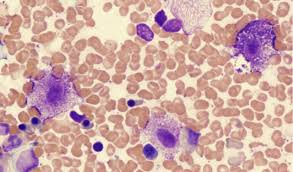 Marrow's main job is to make blood cells. Mast Cell Tumors In Dogs Petcoach