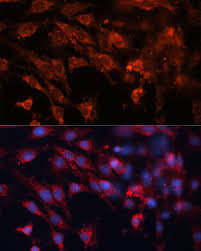 Primary (idiopathic), secondary or innate origin of glomerulonephritis also should be. Igf2r Antibody Mybiosource