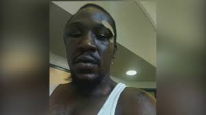 Ex-officer accuses chief, NC city of slander in police beating