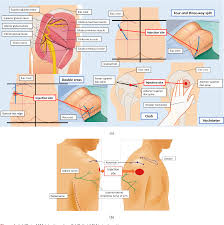 Image result for Intramuscular Injection