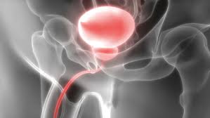 Diese drüse sezerniert notwendige nährstoffe während der ejakulation, um spermien zu helfen. Prostata Richtig Behandeln Toppharm Ch