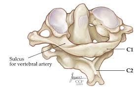 Supraspinous ligament, which spans from the occipital. Biomechanics Of The Craniovertebral Junction Intechopen