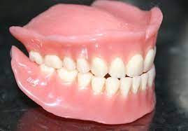 This is when the patient goes for days or sometimes weeks without having teeth while their dentures are being made. Dentures Complete Guide To Types Costs Benefits