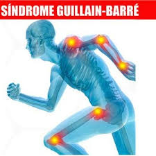 Los primeros síntomas suelen ser debilidad y hormigueo en las extremidades. Stream Sindrome De Guillian Barre By Luce Marticorena Listen Online For Free On Soundcloud