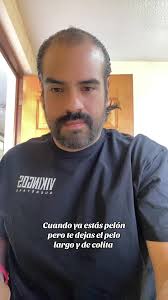 Pelones Con Pelo Largo