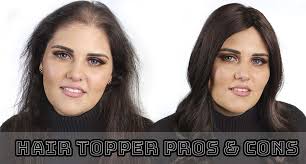 Check spelling or type a new query. Hair Toppers Before And After Look At Its Pros And Cons