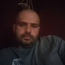 Chopped Arm PRANK 😂