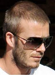 Comment Se Coiffer Quand On Perd Ses Cheveux