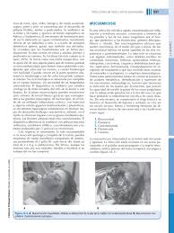 Estudio de cohorte de su tratamiento de acuerdo a la extensión de la enfermedad y reversión de su fisiopatología. Mucormicosis Epidemiologia Inmunologia