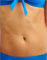 Epingle Sur Body Positivity