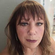 Will knee stiffness and aching stop after total knee replacement surgery?