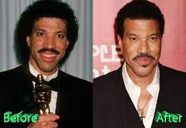 Lionel richie, diana ross — endless love 04:25. Lionel Richie Before And After Plastic Surgery Celebrity Plastic Surgery Lionel Richie Botox Injections
