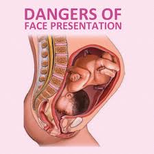Image result for Face Presentation