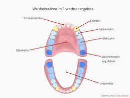 Eigentlich müssten die milchsäurebakterien bei den temperaturen, bei denen ein weißbrot gebacken wird, doch absterben, oder? Weisheits Zahnentfernung Und Op In Hamburg Zahnklinik Abc Bogen