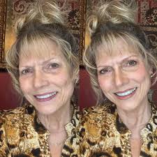 Yesterday's before and after! @everyone