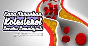 Tekanan darah yang kurang dari 120/80 mmhg diaggap normal. Cara Kurangkan Kolesterol Tinggi Dalam Darah Diet Darah