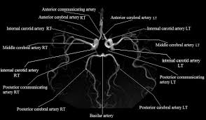 Maybe you would like to learn more about one of these? Radiology Anatomy Images Anterior Communicating Artery Anterior Cerebral Artery Rt Mri