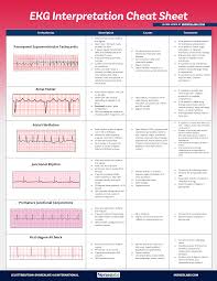 Ekg Interpretation Cheat Sheet Heart Arrhythmias Guide 2020 Update