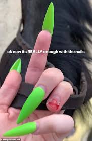 Acrylic nails are basically artificial nails that can be adorned with amazing designs to add a glam look to your 13. Billie Eilish Reveals Her Acrylic Nail Was Ripped Off And Left Her With A Bloody Finger Daily Mail Online