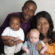 The concentration of one of the types of melanin, called eumelanin, gives the hair a black or brown color, and if this concentration is very low, the blond color. Black Parents Shocked When Son Was Born White