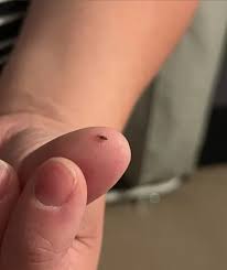 Wife found this in our toddler's hair.😣 Anything we should worry about? He goes to daycare 3 times a week.🤔