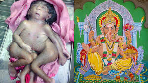 Maybe you would like to learn more about one of these? Baby Born With Eight Limbs Worshipped By Thousands As Hindu God Mirror Online