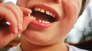Knocked Out Baby Tooth Saves Florida Teen From Felony Battery Charge Abc News