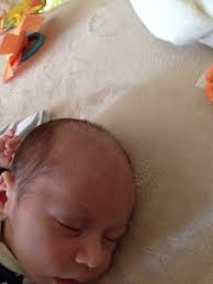 Only in the scalp region.he was born with very good hair but is going bald now.is. Baby Losing Hair September 2015 Babycenter Canada