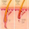 Upper lip hair is not only common with men but some women get it too. 1
