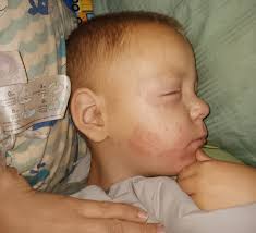 Kayden is doing great he learned where his eye both mouth and ears are I'm  so proud of my boys I'm lucky to have great ones like I do