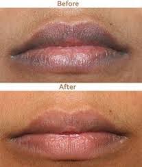 How To Lighten Dark Lips 7 Home Remedies Dark Lips Beauty Skin Care Natural Beauty Skincare