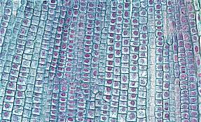 Observing cancer cells under the microscope one of the more useful and essential uses of microscopy is in identifying, analyzing, and treating certain diseases, ranging anywhere from bacterial and viral infections, to something a lot more serious and fatal, such as cancer. Pin By Gertrude Sarmiento On Home Decorating Ideas Things Under A Microscope Cell Color Textures