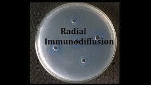 Radial immunodiffusion (mancini)interpretationdiameter of ring is proportional to the concentrationquantitativeig levels ,c3,c4 conc. Radial Immunodiffusion Teaching Kit Youtube
