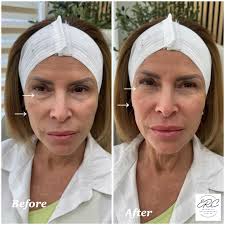 Eileen Ruiz-Cruz, APRN