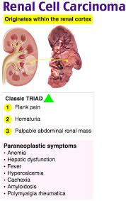 Renal Cell Carci Renal Cell Carcinoma Renal Family Medicine