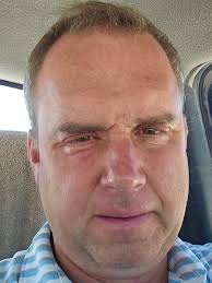 A Shot in the Ass or the Ballad of $53.13