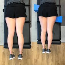 Image result for Functional Leg Length Discrepancy