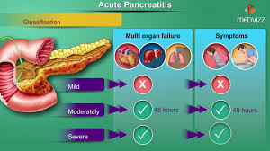 Maybe you would like to learn more about one of these? Acute Pancreatitis Etiology Signs And Symptoms Pathophysiology Diagnosis Treatment Youtube