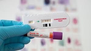 Satgas Rapid Test Antigen Bisa Digunakan Di Ri Sesuai Rekomendasi Who