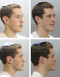 Does Facial Growth Continue As We Age? - Spear Education