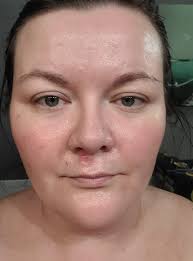 Is slugging good for dry skin? What are results?