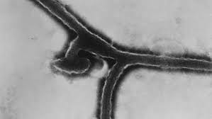 Cases are extremely rare with the last major outbreak in angola in 2005. Vor 50 Jahren Marburg Virus Wird Unter Dem Mikroskop Entdeckt Archiv