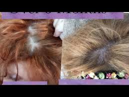 It's been a crazy 6 months of hair growth and i think my. Biosil Review After 3 Months Youtube